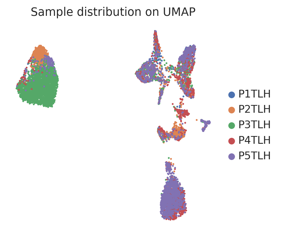 MacParland human liver sample UMAP